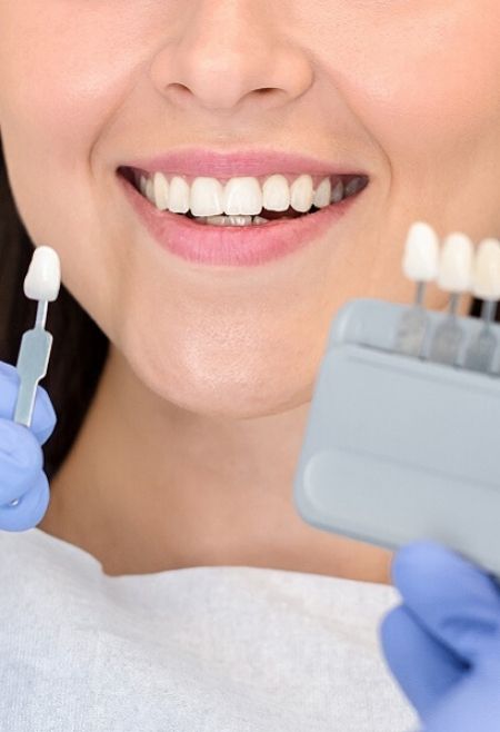 Tratamientos-de-Estética-Dental-Clinic-Mallorca-MED