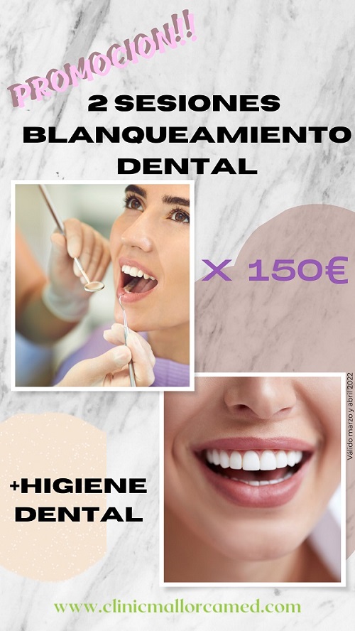 Oferta Blanqueamiento Dental Clinic Mallorca MED